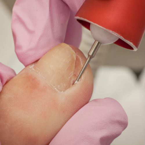 Mobile Foot Care Calgary